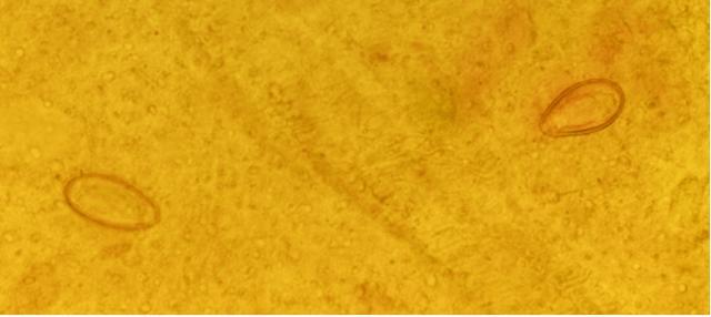 例春节聚餐这口“鲜”可能让它找上门！pg模拟器电脑版发现多例本地感染病(图2)